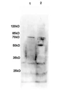no bands:signal.webp