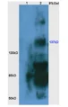 smeared.webp