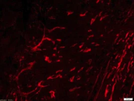 ns staining.webp