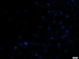 no or weak staining.webp