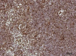 overstaining.webp